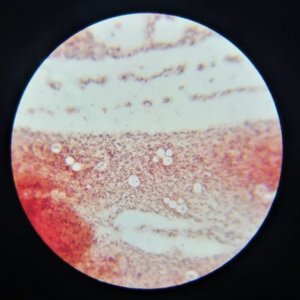 microorganismo, foto cortesía de Farenheit DDB